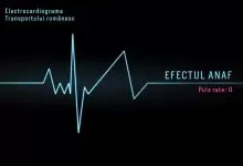 Transportatorii, reîncadrarea diurnelor, incoerența și ANAF-ul