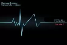 UNTRR solicită companiilor de transport polițe RCA pentru a demonstra ASF-ului că acesta a crescut 11 UNTRR solicită companiilor de transport polițe RCA pentru a demonstra ASF-ului că acesta a crescut