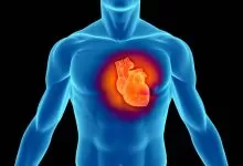 Campanie MAN de prevenire a infarctului în rândul șoferilor de camion