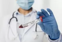 Olanda relaxează testarea șoferilor care vin din Marea Britanie 14 Unde pot face șoferii de camion teste COVID în Austria